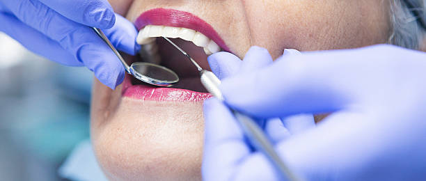 Best Emergency Broken Tooth Repair in Mayville, MI
